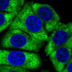 Ribosomal Protein L24 Antibody, Novus Biologicals 0.1mL; Unlabeled:Antibodies,